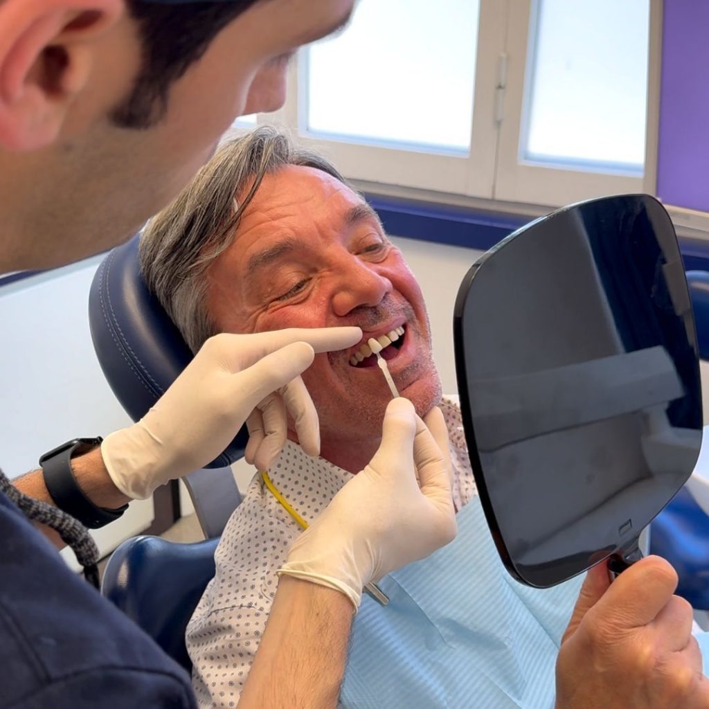 Faccette Dentali 5 Faccette dentali a Firenze