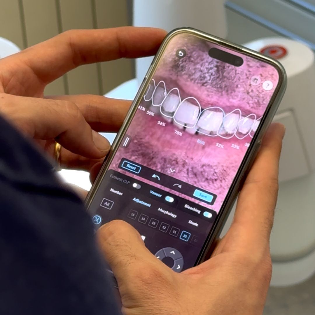Bagno a Ripoli 16 Faccette dentali a Firenze - studio dentistico a Bagno a Ripoli