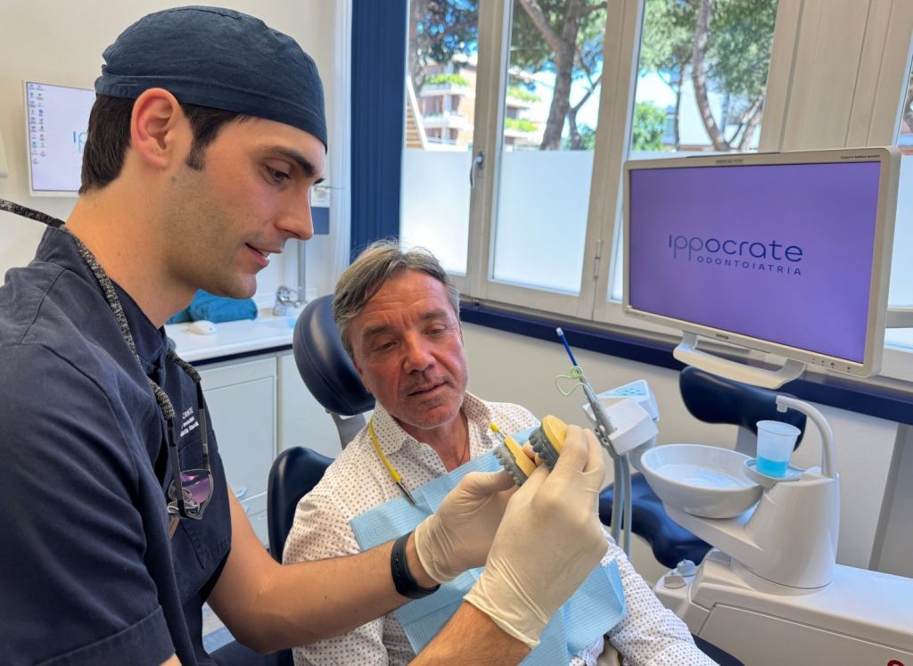 Cosa Sono le Faccette Dentali: Guida Completa 1 Cosa sono le faccette dentali