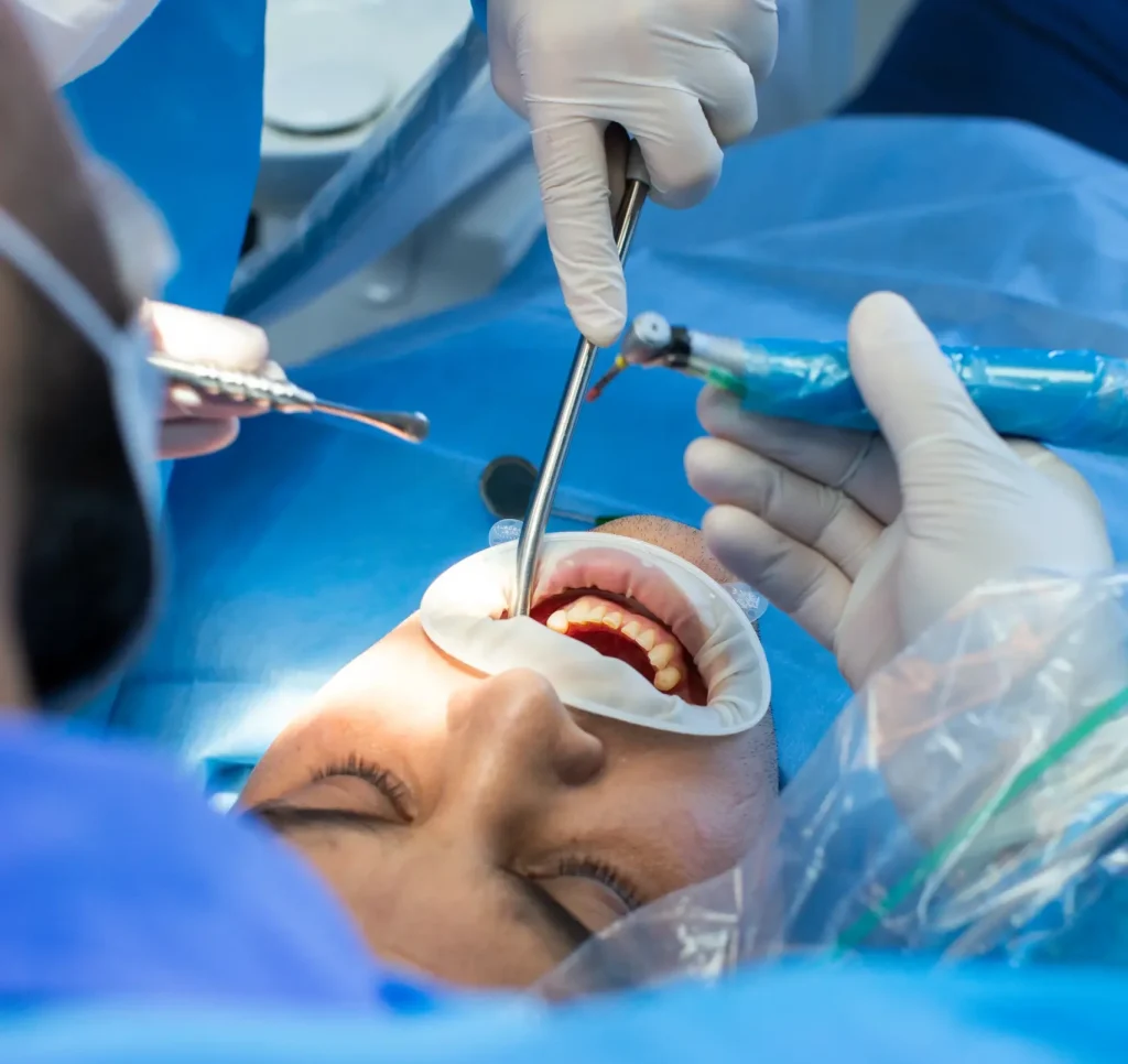 Posso fumare dopo aver tolto il dente del giudizio? 1 fumare dopo aver tolto il dente del giudizio