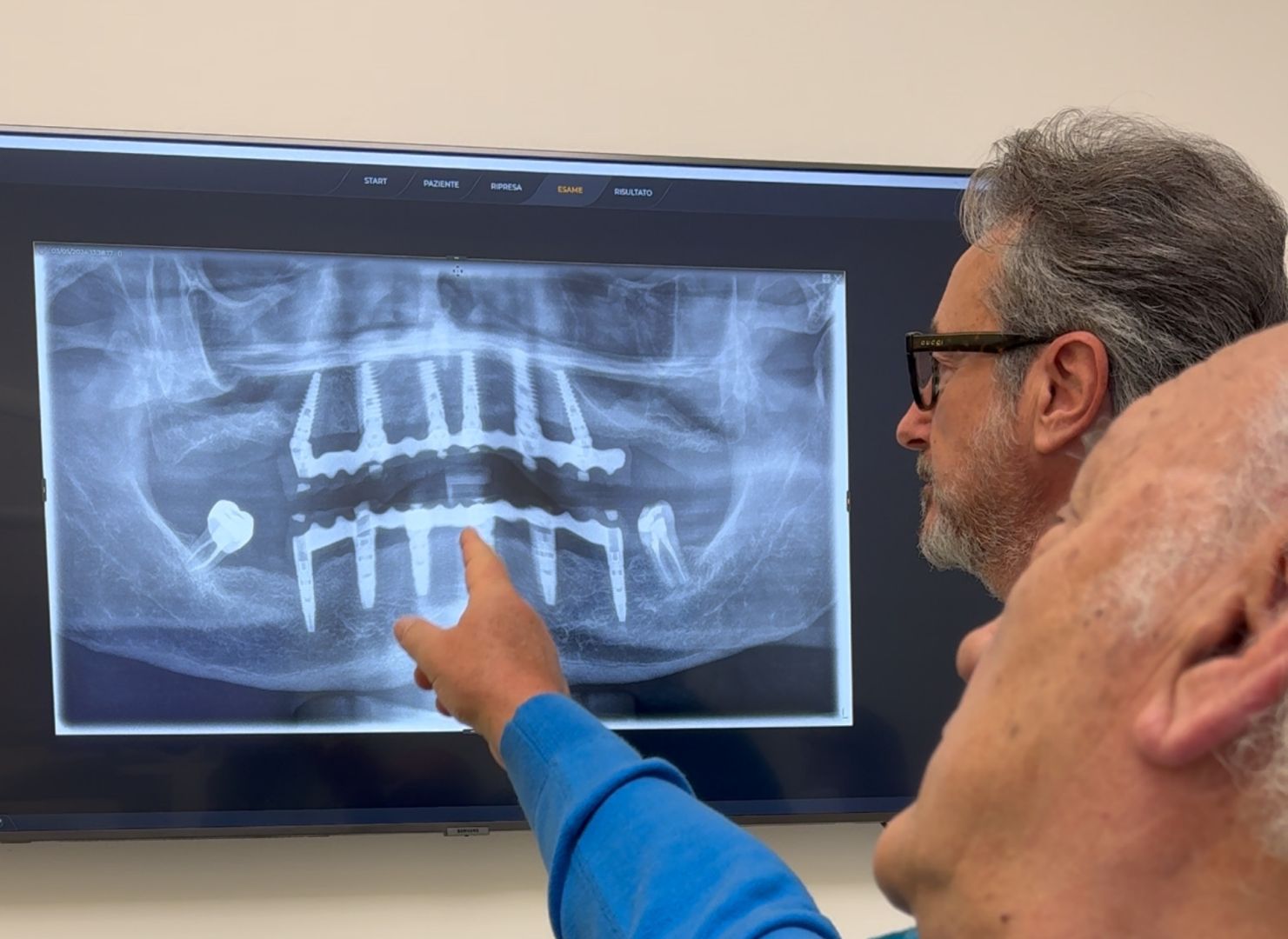 Bagno a Ripoli 5 Implantologia a Firenze - studio dentistico a Bagno a Ripoli