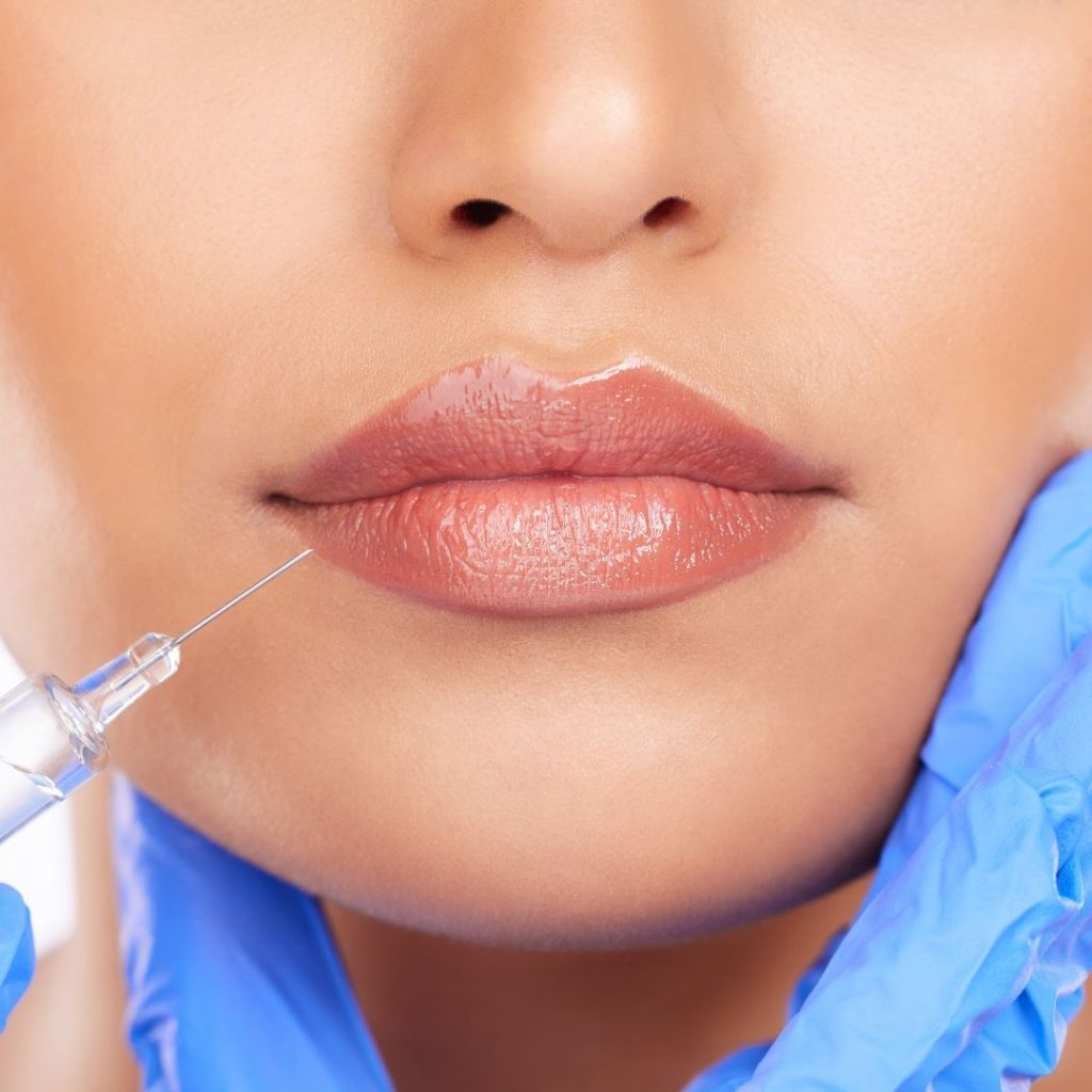 Medicina estetica 1 Filler labbra a Firenze