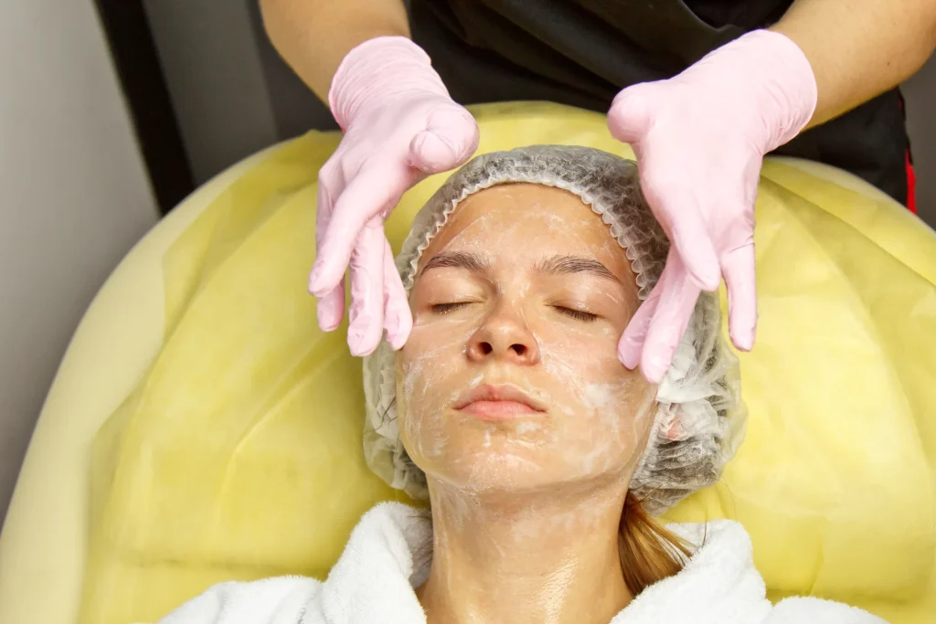 peeling viso